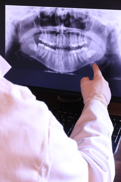 Best Emergency Wisdom Teeth Removal in Grovetown, GA